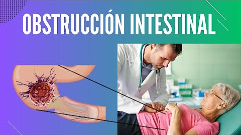 ¿Cuál es la gravedad de una obstrucción intestinal?