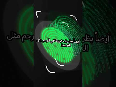 بصمة الإنسان فريدة لدرجة أنها يمكن أن تحدد التوائم  