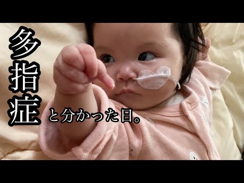 【4pマイナス症候群】ピナちゃんの【多指症】をゆっくり観察♡