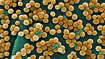 Science Bulletins: MRSA—The Evolution of a Drug-Resistant Superbug