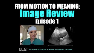 From Motion to Meaning: ULA Image Review Episode 1