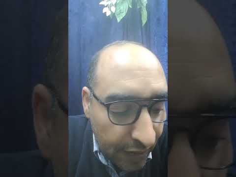 اسعار الخردة 23 12 2024