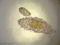 Water bear tardigrade meets paramecium