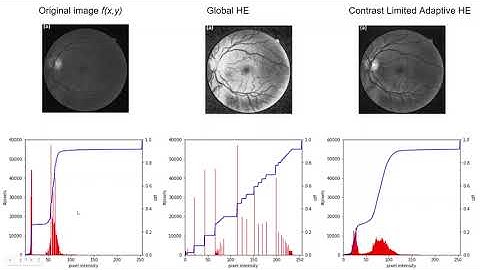 Python#4 Histogram Equalization and Adaptive Histogram Equalization in Python