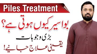 Piles Causes & Treatment  Khooni Aur Badi Bawasir Ka Ilaj | By Dr. Idrees Gondal