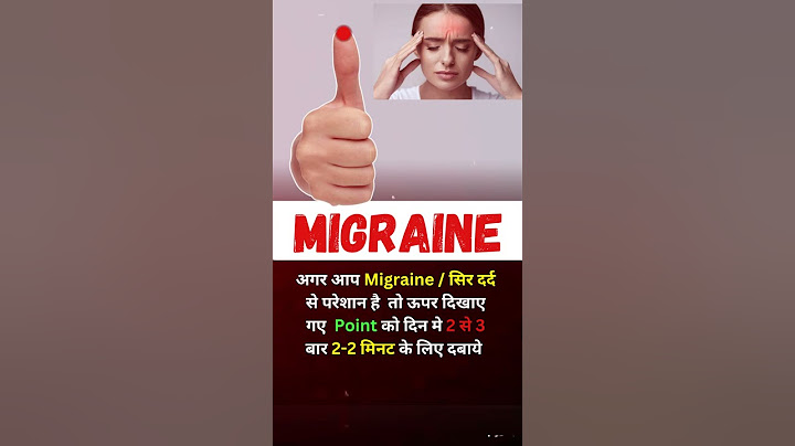 Migraine : सिर दर्द का रामबाण इलाज | Acupressure point | smt clinic✅