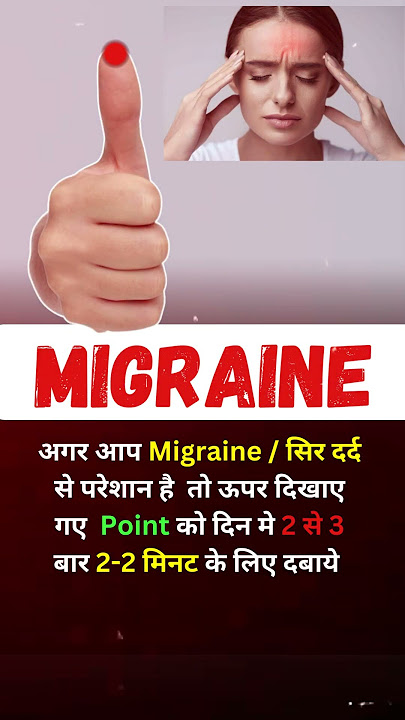 Migraine : सिर दर्द का रामबाण इलाज | Acupressure point | smt clinic✅