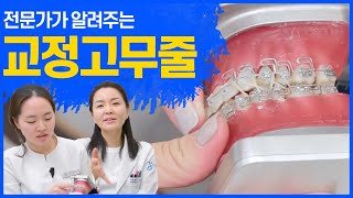 전문가가 알려주는 치아교정시 고무줄 쉽게 사용하는 방법.