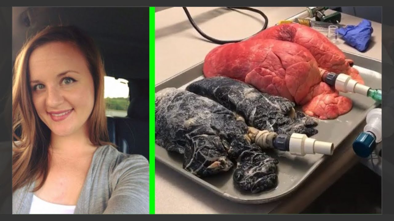 Ces Images Troublantes D Une Infirmiere Qui Gonfle Des Poumons Sains Et De Fumeur Revelent Ce Youtube