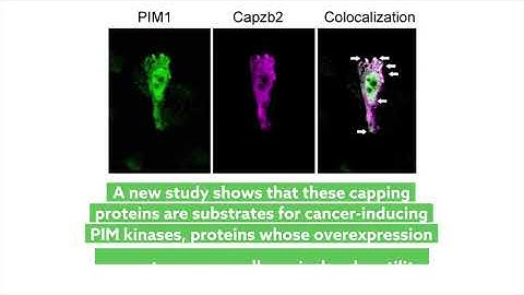 PIM1 accelerates prostate cancer cell motility by phosphorylating actin capping proteins