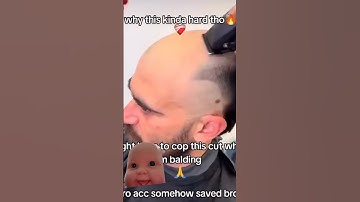 Baby reacts to bald man #bald #man# YouTube #shorts #youtubeshorts