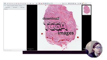 Download cancer images from TCGA