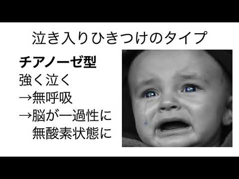 泣き入りひきつけ（憤怒けいれん）の原因、対処法を小児科医が解説
