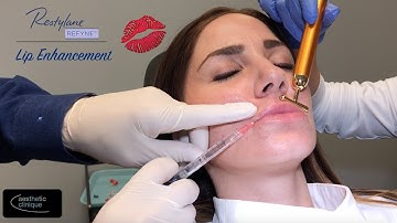 Restylane Refyne Lip Enhancement