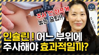 당뇨인 인슐린 주사! 안전하고 효과적인 인슐린 흡수를 위한 주사부위는? | 당뇨병의 정석 | 당뇨병학회