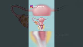 “क्या आप जानते हैं टेस्ट ट्यूब बेबी ऐसे बनते हैं? पूरा सच जानिए!”#IVF #TestTubeBaby #IVFTreatment