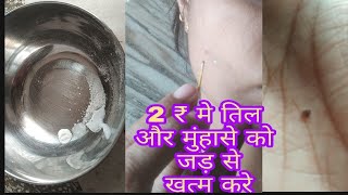 चेहरे पर तिल और मुंहासे को हटाए 10मिनट मे mole removetil ko kaise hataye