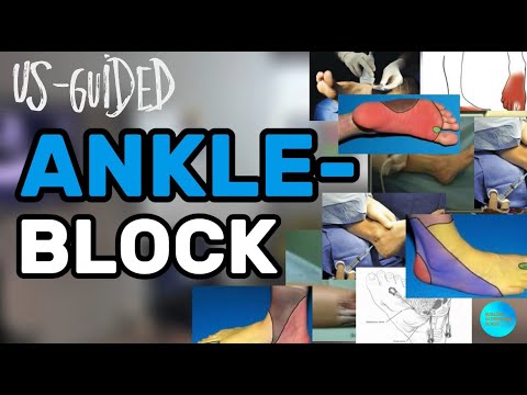 ВЫ ОСВОИТЕ ANKLE-BLOCK ЗА 15 МИНУТ! #узи #anatomy #ultrasound #anaesthesia #anaesthesiology