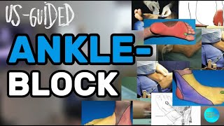 картинка: ВЫ ОСВОИТЕ ANKLE-BLOCK ЗА 15 МИНУТ! #узи #anatomy #ultrasound #anaesthesia #anaesthesiology