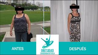 Video de antes y después de la Cirugía de la Obesidad