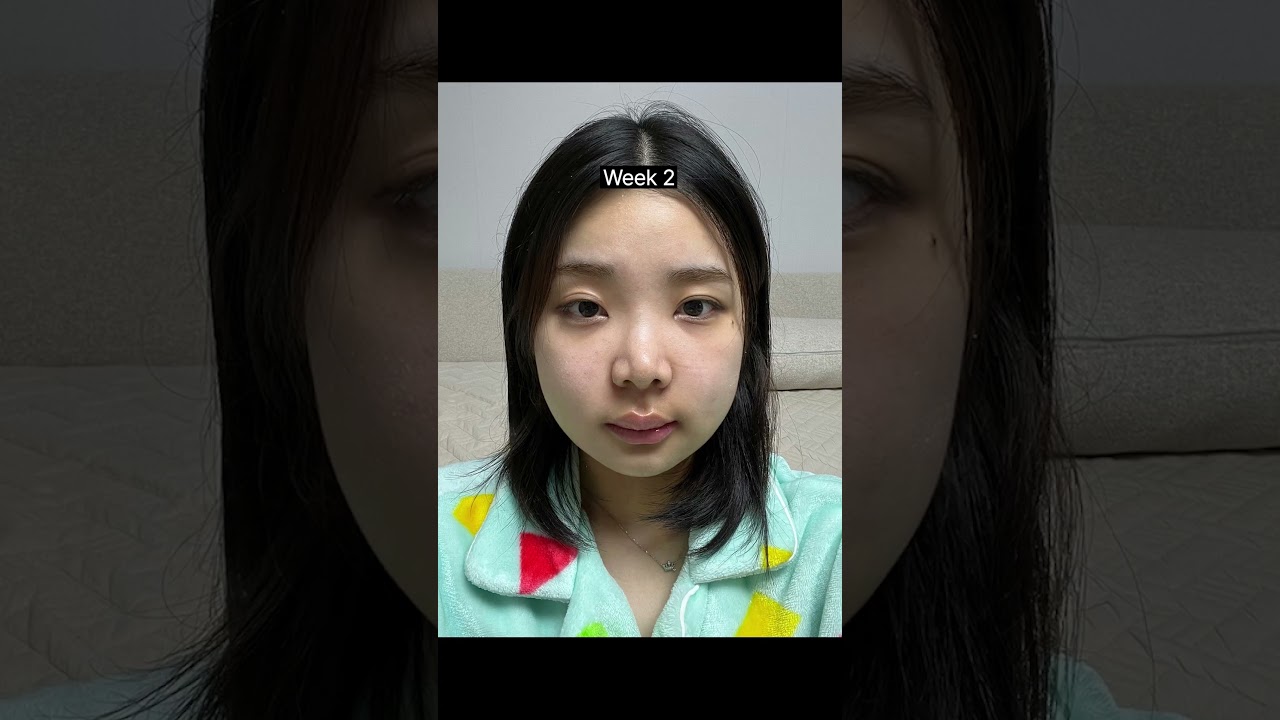 등록한썸네일