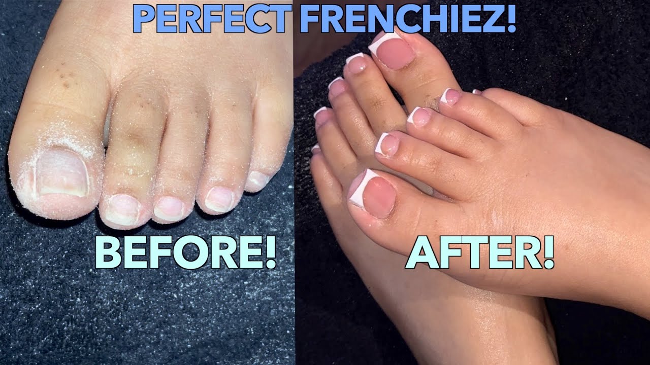 FRENCH ACRYLIC TOES ACRYLIC OVERLAY ON TOES YouTube FRENCH ACRYLIC TOES ACRYLIC OVERLAY ON TOES YouTube