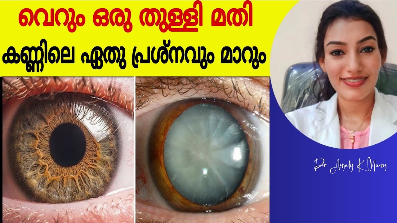 കണ്ണിലെ dryness, ചൊറിച്ചിൽ, കാഴ്ച കുറവ്| എല്ലാത്തിനും പരിഹാരം | Dr Anjaly K Manoj 