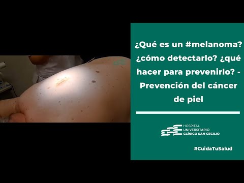 Video: ¿Melanoma siempre significa cáncer?