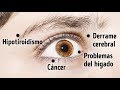 8 Cosas Que Tus Ojos Dicen Sobre Tu Salud