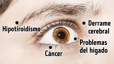 ¿Qué significan los ojos apagados?