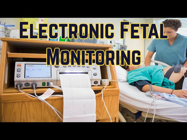 What fetal heart rate monitoring can – and can't – tell us, Your Pregnancy  Matters