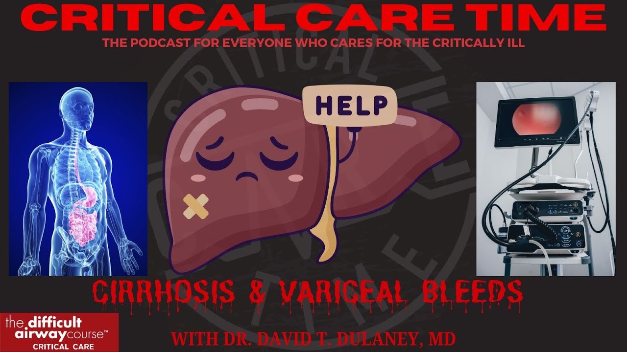 55. Cirrhosis & Variceal Bleeds