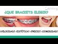 ORTODONCIA Precio y tipos de brackets 2018