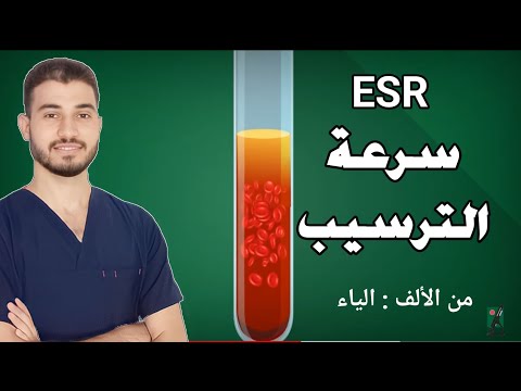 ما هو تحليل سرعة الترسيب في الدم رخيص و مهم جدا لصحتك دليل شامل دروس طبية