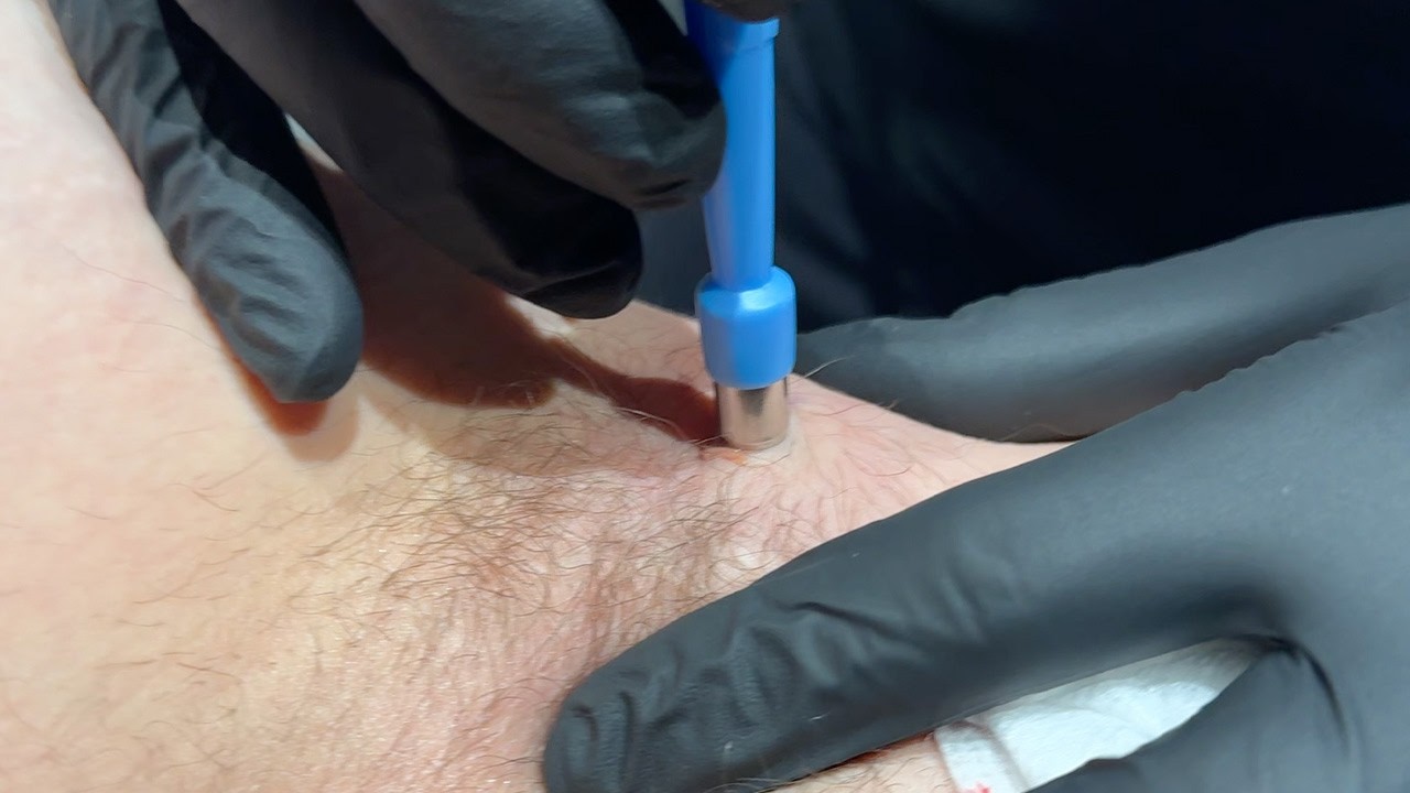 How To Remove Armpit Smell From Jacket Without Washing