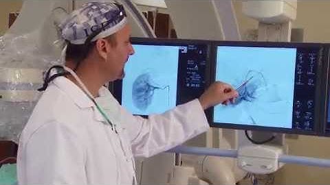 Discover Health Episode 8 - Kidney Embolization at Spartanburg Regional Healthcare System