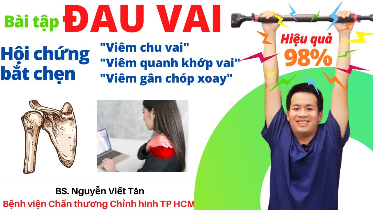 Bài tập đau vai do hội chứng bắt chẹn, viêm chu vai, viêm gân chóp xoay ...