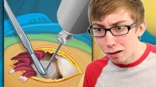 HIP SURGERY (iPhone Gameplay Video)