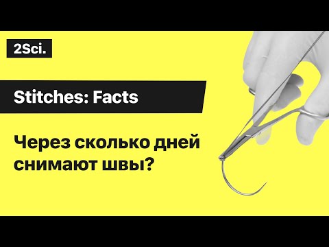 Через сколько дней снимают швы? 🤔 Почему швы снимают через 10 дней?