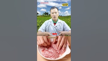 Chữa khỏi Rối loạn Tiền đình bằng Óc heo hấp rượu|Trần Văn Luận