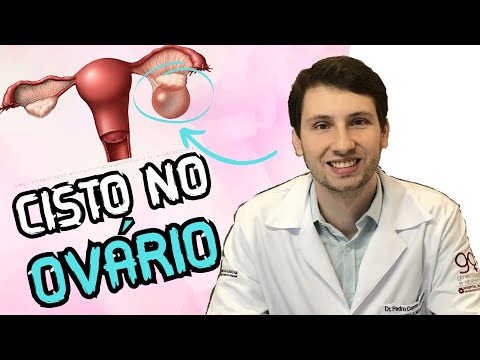Vídeo: Cisto de ovário é normal?