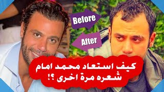 شعر الفنان محمد امام | رحلة محمد عادل امام مع الصلع الوراثي منذ اول ظهور له