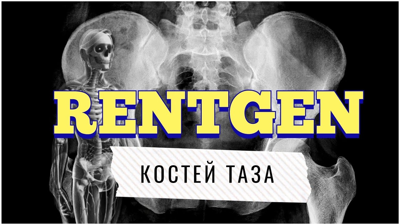 Рентген таза: учимся читать рентген костей таза📖🙈