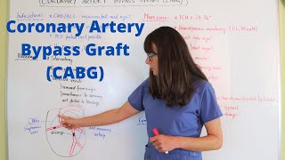 Coronary Artery Bypass Graft (CABG)