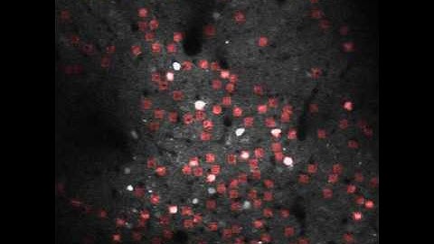 Auditory cortex activity