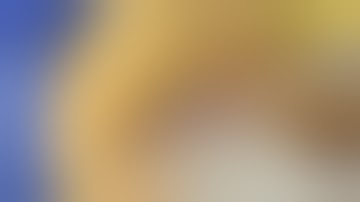 Bilateral Anterior Component Separation Short Technique Video - Dr John P. Fischer