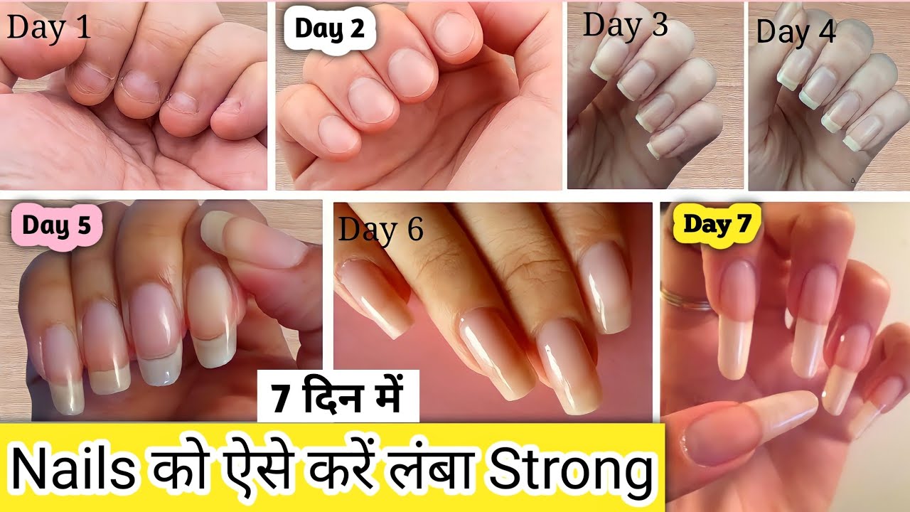 नाखूनों को लम्बे मजबूत और सुंदर बनाने के रामबाण उपाय || Strong Nail Growth  Tips in Hindi - YouTube