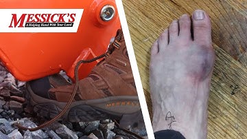 How to avoid this painful mistake when removing your bucket.