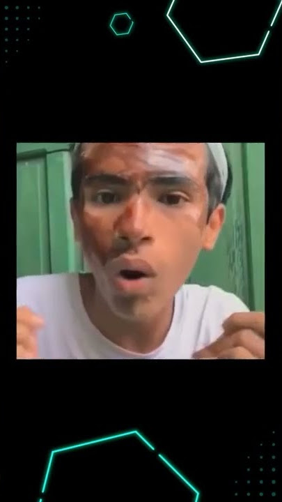 kumis e hilang