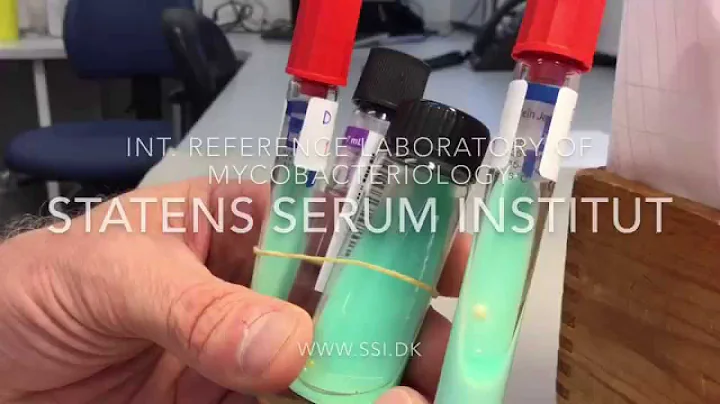 Mycobacteria chimaera analysis